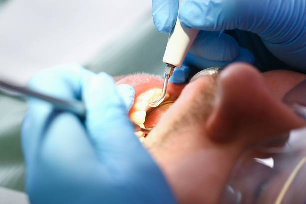 Best Emergency Tooth Extraction in New Lisbon, WI